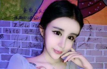 PICS: 15-Year Old Undergoes Extreme Plastic Surgery To Win Back Her Ex