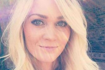 PIC: This Woman Posted A Graphic Harsh Reminder Why You Should NEVER Use A Sunbed