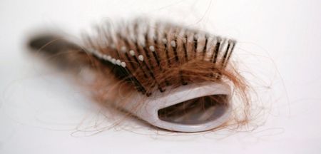 These Lifestyle Habits Could Be Making You Bald