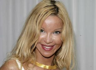 Alicia Douvall Wants Cosmetic Surgeons To ‘Protect Vulnerable Girls’