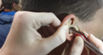WATCH: A Man Had His Impacted Ear Wax Removed And Filmed… It Is DISGUSTING