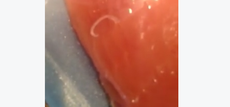 WATCH: A Woman Bought Fresh Fish… And Found Worms Crawling In The Skin