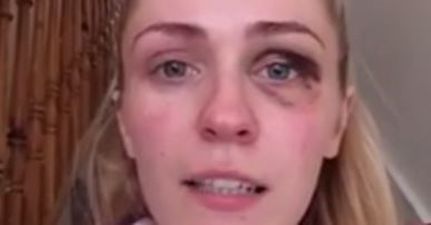 Irish Woman Speaks Out About Experience of Domestic Violence
