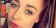 PIC: Teen Suffers Horrific Allergic Reaction To Eyebrow Threading And Dye Treatment