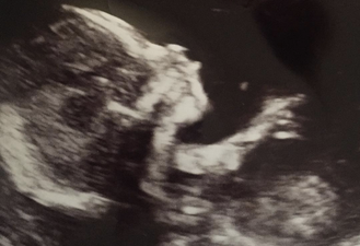 TOWIE Favorite Kirk Norcross Announces Exciting Baby News