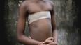 Horrendous Practice Of ‘Breast Ironing’ Taking Place In The UK