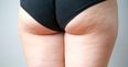 These Three Simple Skincare Tips Will Help Reduce The Appearance of Cellulite