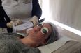 I Tried IPL Skin Rejuvenation Treatment and This Is What Happened