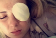 Student Rips Out Her Own Cornea After Trying To Remove Contact Lens