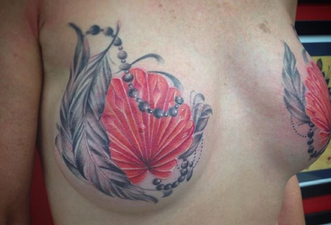 Instagram Shut Down Account Of Breast Cancer Survivors For Being ‘Too Sexual’