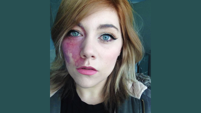 This Woman Was Told She Was Too Ugly For Love