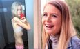 PICS: These Incredible Photos Show How One Dangerously Ill Anorexic Teen Was Able to Turn Her Life Around