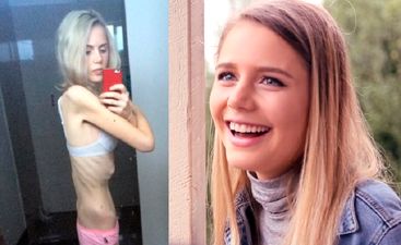 PICS: These Incredible Photos Show How One Dangerously Ill Anorexic Teen Was Able to Turn Her Life Around