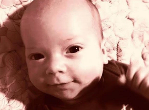 Dad Shares Photo Of His Baby’s Foot To Raise Awareness Of Dangerous Condition