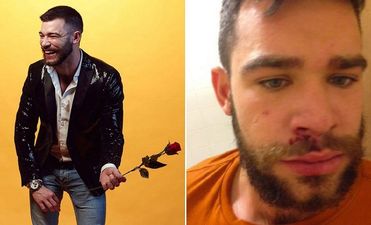 A First Dates Contestant Has Been The Victim Of A Homophobic Attack