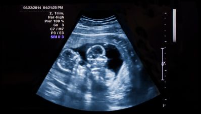 Two-Year-Old Twins Who Look Nothing Alike Found To Have Different Fathers