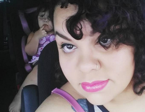 PICS: Woman Shares Warning After Single Piece Of Glitter Causes Her To Lose Her Eye