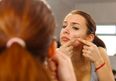 Apparently You Should Never Pop a Pimple and Here is Why