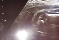 PIC: Expecting parents see shape of sports car on ultrasound scan