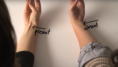 Do you have a vein on your wrist? This is what it is