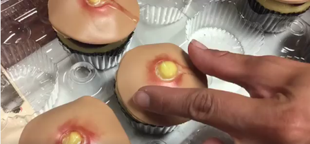 Zit-popping inspired cakes are a thing now and they look revolting
