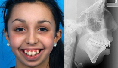 This young woman’s transformation after corrective surgery is absolutely incredible