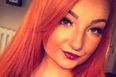 A young woman has died after mistaking Meningitis symptoms for a hangover