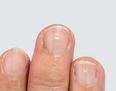 Here are the reasons why you may have white marks on your nails