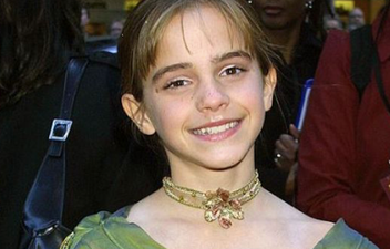 Did you notice this about Emma Watson’s teeth in Harry Potter?