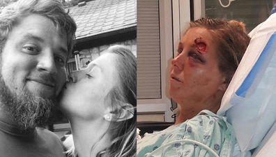  Young woman talks about the reality of abuse after boyfriend rips out her tongue