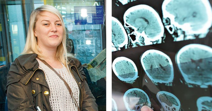 An Irish girl speaks about going blind after mistaking a brain tumor for a migraine