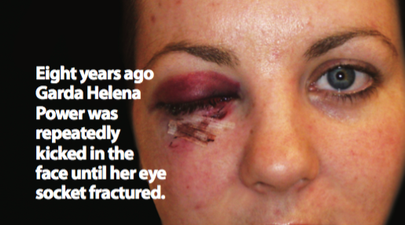 The story behind this injured Garda’s photo is something everyone should read