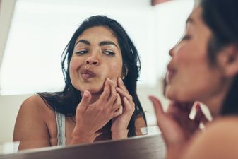 This expert tip is a gamechanger for concealing acne
