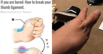 People are trying to break their thumbs because of this stupid Internet picture