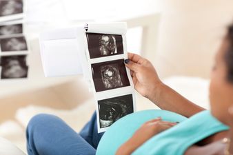 Dad claims he was fired for missing work for the birth of his son