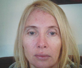 A Dublin woman is sharing the side effects of her cancer treatment to raise awareness