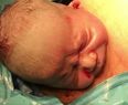 WATCH: Baby’s head ‘pops out’ of mum during ‘gentle C-section’