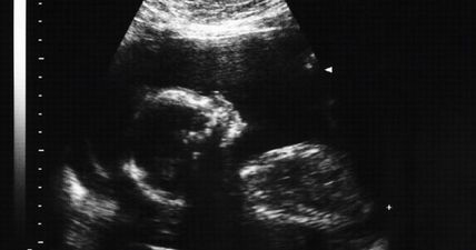 The HSE will publish a review of maternity services complaints next week