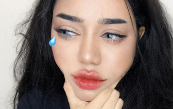 Blogger hits back at followers who ask what’s ‘wrong’ with her eye