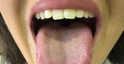 We had tongue readings and the results left us shook