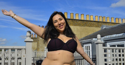 This blogger wants women not to be scared of their scars