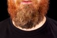 Now we know why some non-ginger men have ginger beards