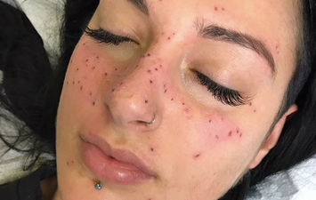 Tattooing freckles of your astrology sign is now a thing and we’re fairly confused