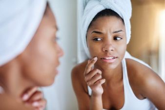 Christmas Congestion – battle breakouts during party season