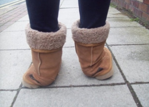 thigh-high uggs