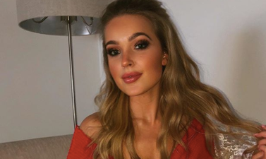 Model shares ‘gruesome’ photos to remind people about the dangers of sunbeds