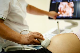 Woman thinks coworker is ‘faking’ pregnancy after seeing ultrasound photo