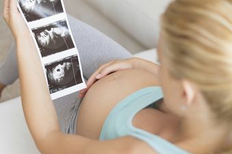 Pregnant women are using an odd technique to figure out the sex of their baby