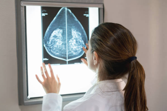 Breast cancer screening failure means 270 women in UK may have had lives ‘shortened’