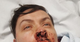 Couple left severely injured after suspected homophobic attack
